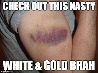 Check out this nasty White & Gold Brah | CHECK OUT THIS NASTY WHITE & GOLD BRAH | image tagged in the dress,blue and black,white and gold | made w/ Imgflip meme maker