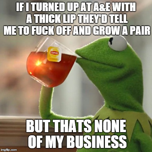 Top Gear Kerfuffle | IF I TURNED UP AT A&E WITH A THICK LIP THEY'D TELL ME TO F**K OFF AND GROW A PAIR BUT THATS NONE OF MY BUSINESS | image tagged in memes,but thats none of my business,kermit the frog | made w/ Imgflip meme maker