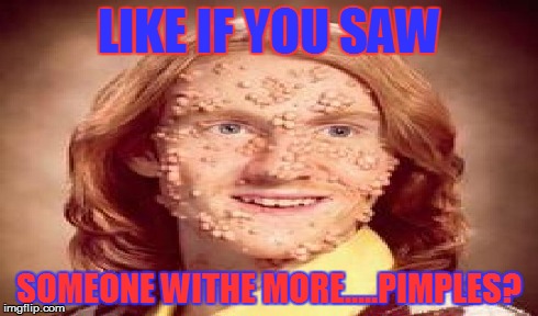 pimples? | LIKE IF YOU SAW SOMEONE WITHE MORE.....PIMPLES? | image tagged in pimple mani think | made w/ Imgflip meme maker