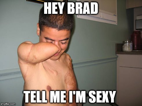 HEY BRAD TELL ME I'M SEXY | image tagged in amputation,sexy | made w/ Imgflip meme maker