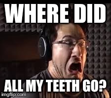 omg radio | WHERE DID ALL MY TEETH GO? | image tagged in omg radio | made w/ Imgflip meme maker