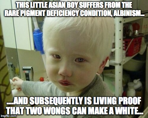 two wongs | THIS LITTLE ASIAN BOY SUFFERS FROM THE RARE PIGMENT DEFICIENCY CONDITION, ALBINISM... ….AND SUBSEQUENTLY IS LIVING PROOF THAT TWO WONGS CAN  | image tagged in funny | made w/ Imgflip meme maker