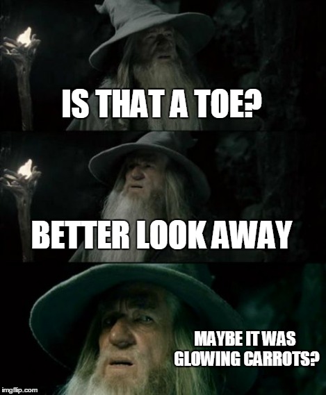 Confused Gandalf Meme | IS THAT A TOE? BETTER LOOK AWAY MAYBE IT WAS GLOWING CARROTS? | image tagged in memes,confused gandalf | made w/ Imgflip meme maker