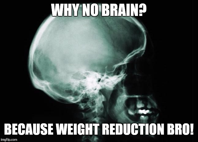 WHY NO BRAIN? BECAUSE WEIGHT REDUCTION BRO! | image tagged in brainless x-ray | made w/ Imgflip meme maker