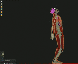What Miley Cyrus' wrecking ball should do to her | image tagged in gifs,scumbag | made w/ Imgflip video-to-gif maker