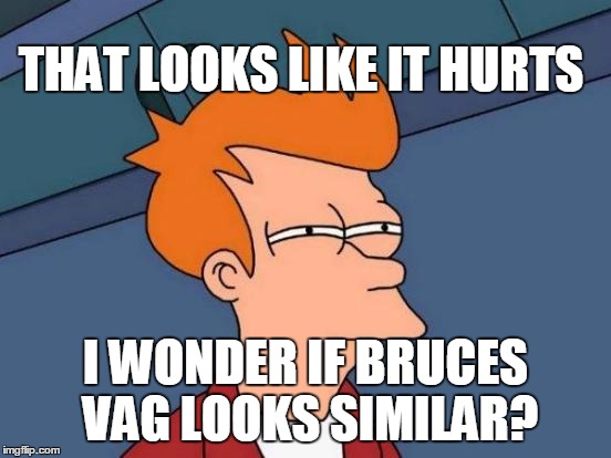 Futurama Fry Meme | THAT LOOKS LIKE IT HURTS I WONDER IF BRUCES VAG LOOKS SIMILAR? | image tagged in memes,futurama fry | made w/ Imgflip meme maker