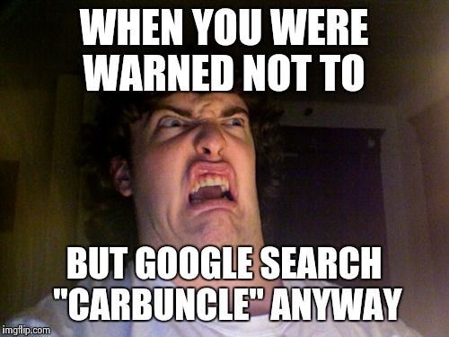 Warning!  Do not try this at home!  | WHEN YOU WERE WARNED NOT TO BUT GOOGLE SEARCH "CARBUNCLE" ANYWAY | image tagged in memes,oh no | made w/ Imgflip meme maker