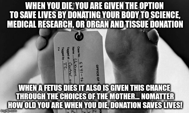 WHEN YOU DIE, YOU ARE GIVEN THE OPTION TO SAVE LIVES BY DONATING YOUR BODY TO SCIENCE, MEDICAL RESEARCH, OR ORGAN AND TISSUE DONATION WHEN A | image tagged in science,organ donation,abortion | made w/ Imgflip meme maker