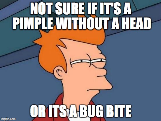 Futurama Fry | NOT SURE IF IT'S A PIMPLE WITHOUT A HEAD OR ITS A BUG BITE | image tagged in memes,futurama fry | made w/ Imgflip meme maker