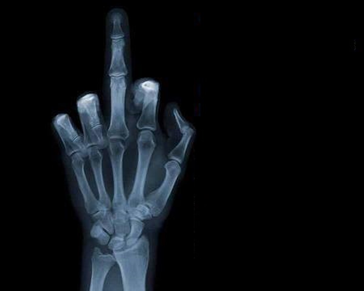 xray finger Blank Meme Template