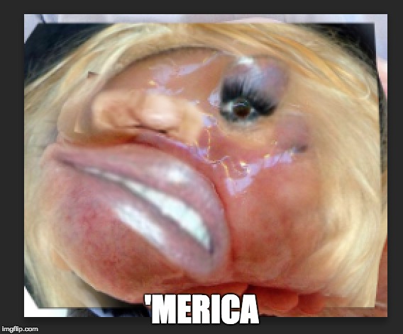 the karmeaoleans | 'MERICA | image tagged in plastic,meme,surgery | made w/ Imgflip meme maker