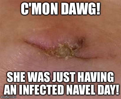 C'MON DAWG! SHE WAS JUST HAVING AN INFECTED NAVEL DAY! | made w/ Imgflip meme maker