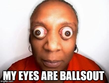 funny eyes | MY EYES ARE BALLSOUT | image tagged in funny eyes | made w/ Imgflip meme maker