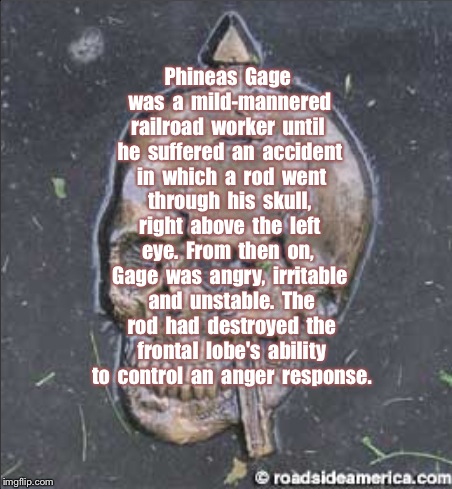 Phineas  Gage  was  a  mild-mannered  railroad  worker  until  he  suffered  an  accident  in  which  a  rod  went  through  his  skull,  ri | image tagged in phineas gage | made w/ Imgflip meme maker