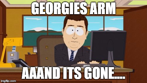 Aaaaand Its Gone Meme | GEORGIES ARM AAAND ITS GONE.... | image tagged in memes,aaaaand its gone | made w/ Imgflip meme maker