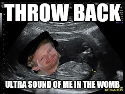 Throw back | THROW BACK ULTRA SOUND OF ME IN THE WOMB | image tagged in funny,baby,throwback,memes | made w/ Imgflip meme maker