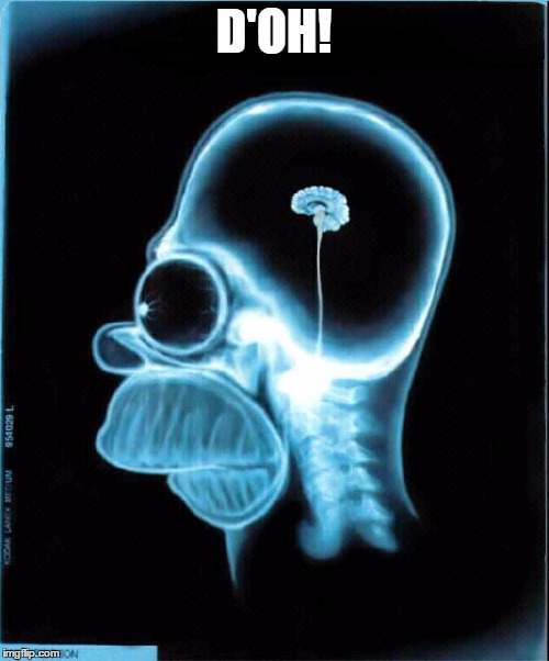 homer simpson x-ray | D'OH! | image tagged in homer simpson x-ray | made w/ Imgflip meme maker