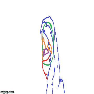 https://i.imgflip.com/vcmjq.gif