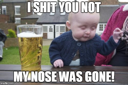 He's not the only one... | I SHIT YOU NOT MY NOSE WAS GONE! | image tagged in memes,drunk baby | made w/ Imgflip meme maker