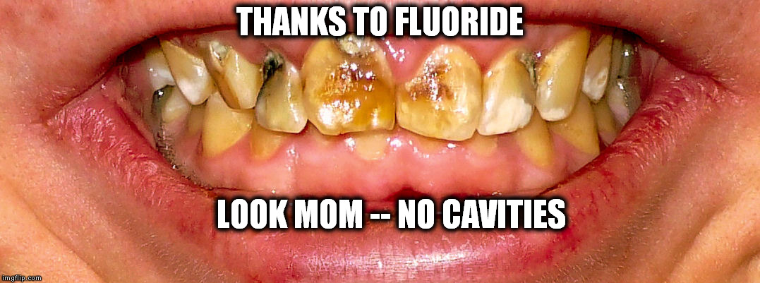 No Cavities | THANKS TO FLUORIDE LOOK MOM -- NO CAVITIES | image tagged in fluoride,dental fluorosis,teeth,bones | made w/ Imgflip meme maker