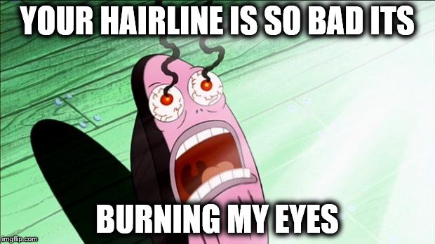 Spongebob My Eyes | YOUR HAIRLINE IS SO BAD ITS BURNING MY EYES | image tagged in spongebob my eyes | made w/ Imgflip meme maker