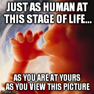 Fetus | JUST AS HUMAN AT THIS STAGE OF LIFE... AS YOU ARE AT YOURS AS YOU VIEW THIS PICTURE | image tagged in fetus | made w/ Imgflip meme maker