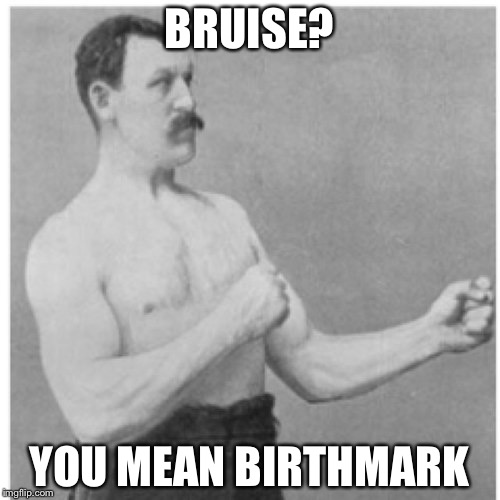 Overly Manly Man Meme | BRUISE? YOU MEAN BIRTHMARK | image tagged in memes,overly manly man | made w/ Imgflip meme maker
