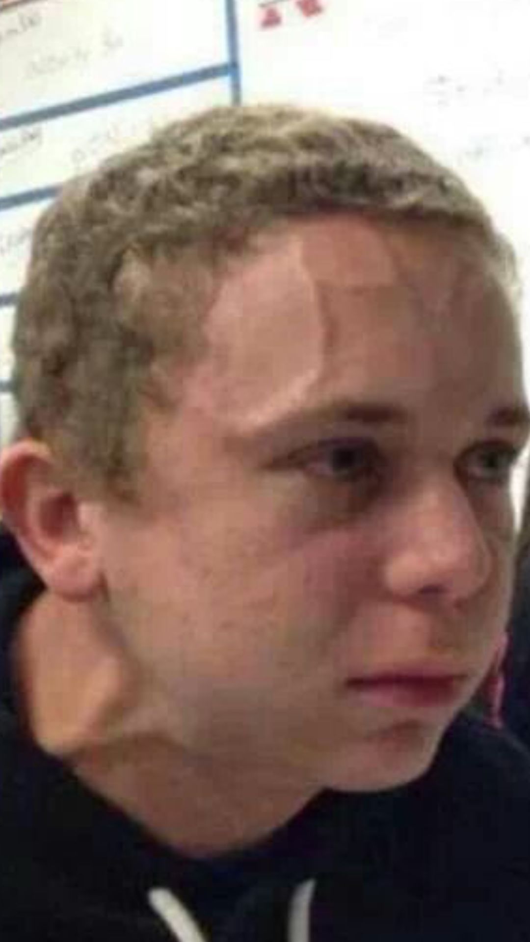 veins Blank Meme Template