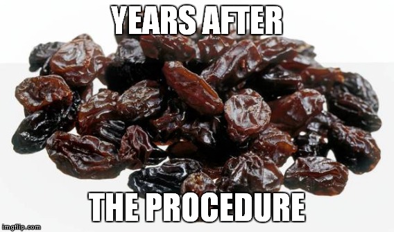 YEARS AFTER THE PROCEDURE | made w/ Imgflip meme maker