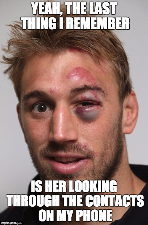 black eye | YEAH, THE LAST THING I REMEMBER; IS HER LOOKING THROUGH THE CONTACTS ON MY PHONE | image tagged in black eye | made w/ Imgflip meme maker