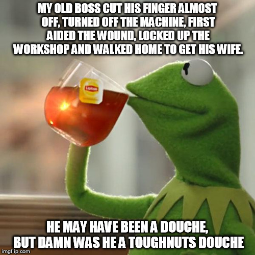 But That's None Of My Business Meme | MY OLD BOSS CUT HIS FINGER ALMOST OFF, TURNED OFF THE MACHINE, FIRST AIDED THE WOUND, LOCKED UP THE WORKSHOP AND WALKED HOME TO GET HIS WIFE | image tagged in memes,but thats none of my business,kermit the frog | made w/ Imgflip meme maker