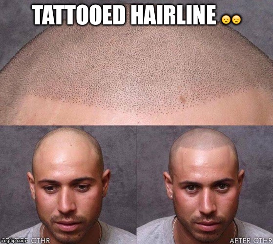 TATTOOED HAIRLINE 😦😦 | image tagged in hair | made w/ Imgflip meme maker
