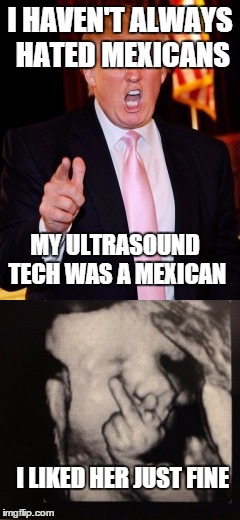 Trump's Ultrasound | I HAVEN'T ALWAYS HATED MEXICANS; MY ULTRASOUND TECH WAS A MEXICAN; I LIKED HER JUST FINE | image tagged in memes,donald trump | made w/ Imgflip meme maker