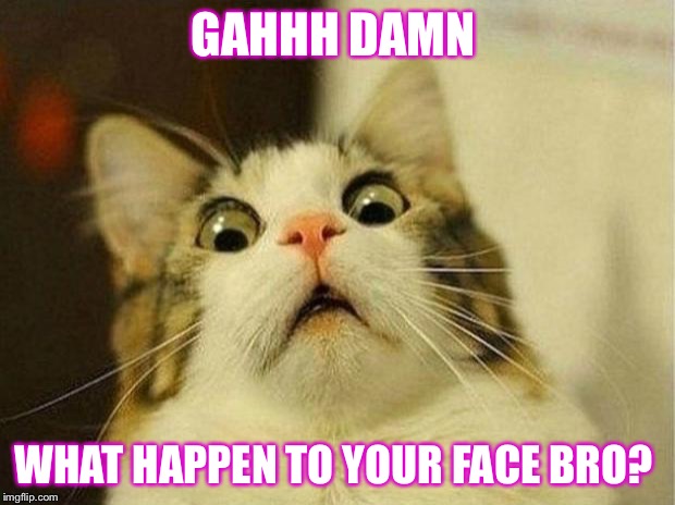 Scared Cat | GAHHH DAMN; WHAT HAPPEN TO YOUR FACE BRO? | image tagged in memes,scared cat | made w/ Imgflip meme maker