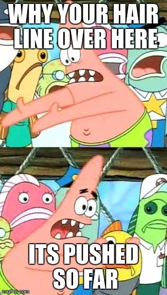 Put It Somewhere Else Patrick Meme | WHY YOUR HAIR LINE OVER HERE; ITS PUSHED SO FAR | image tagged in memes,put it somewhere else patrick | made w/ Imgflip meme maker