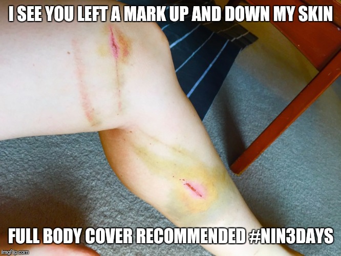 I SEE YOU LEFT A MARK
UP AND DOWN MY SKIN; FULL BODY COVER RECOMMENDED #NIN3DAYS | image tagged in orienteering | made w/ Imgflip meme maker