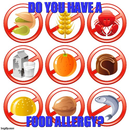 Donna | DO YOU HAVE A; FOOD ALLERGY? | image tagged in donna | made w/ Imgflip meme maker