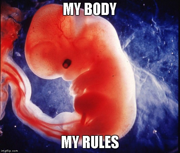 MY BODY; MY RULES | image tagged in my body my rules | made w/ Imgflip meme maker