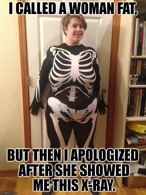 She really WAS big-boned. | I CALLED A WOMAN FAT, BUT THEN I APOLOGIZED AFTER SHE SHOWED ME THIS X-RAY. | image tagged in memes,big boned,funny | made w/ Imgflip meme maker