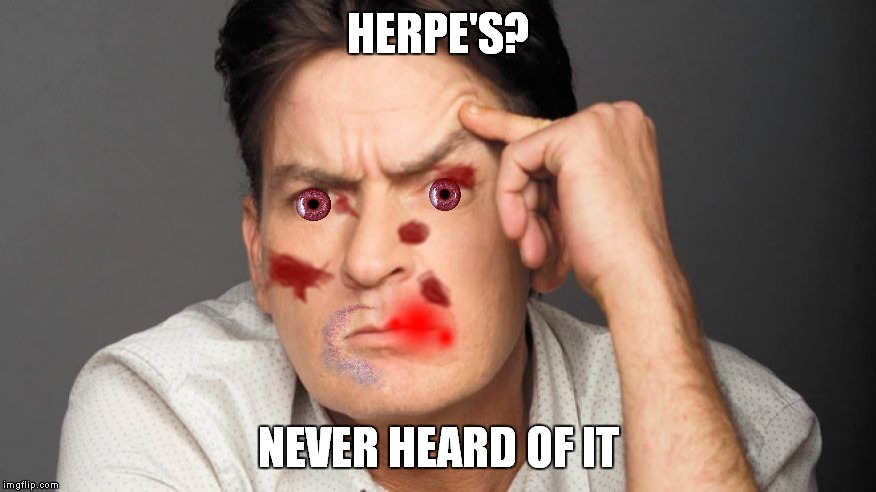 HERPE'S? NEVER HEARD OF IT | made w/ Imgflip meme maker