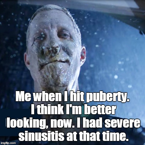 Hey, good lookin' | Me when I hit puberty. I think I'm better looking, now. I had severe sinusitis at that time. | image tagged in trashman | made w/ Imgflip meme maker
