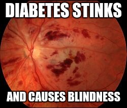 DIABETES STINKS; AND CAUSES BLINDNESS | image tagged in diabetic retina | made w/ Imgflip meme maker