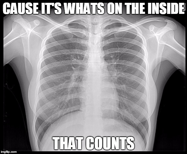 CAUSE IT'S WHATS ON THE INSIDE; THAT COUNTS | image tagged in x ray | made w/ Imgflip meme maker